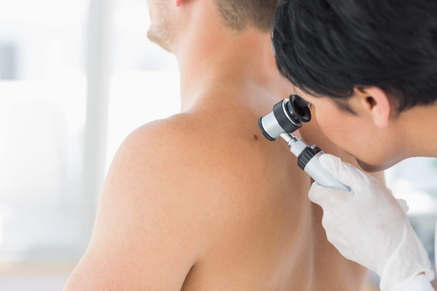 Skin Check In Brisbane