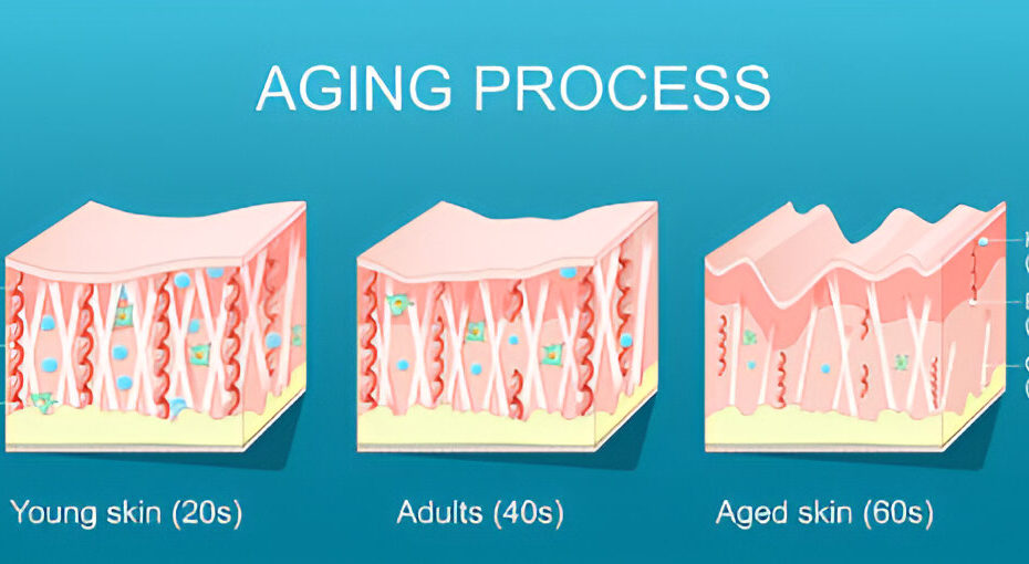 Process of HiFu