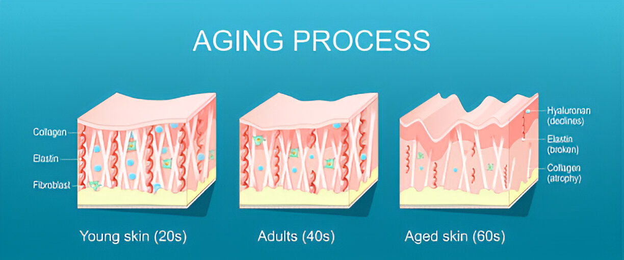 Process of HiFu