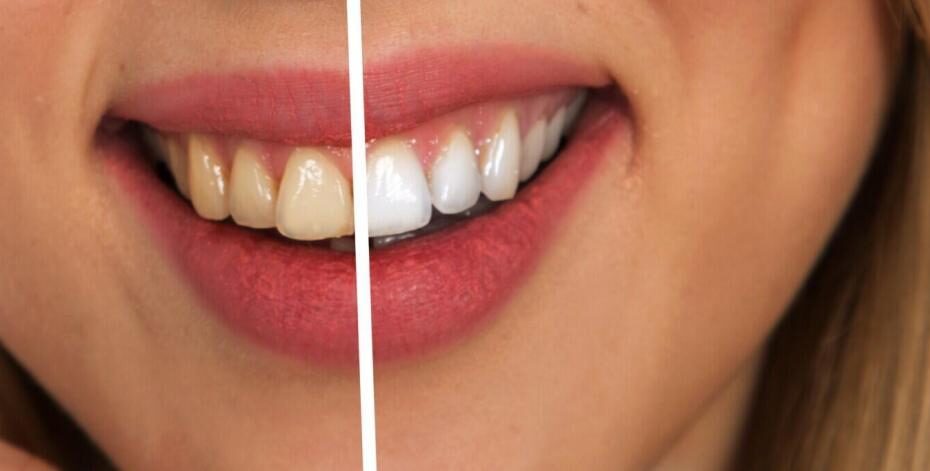 Enhancing Your Smile