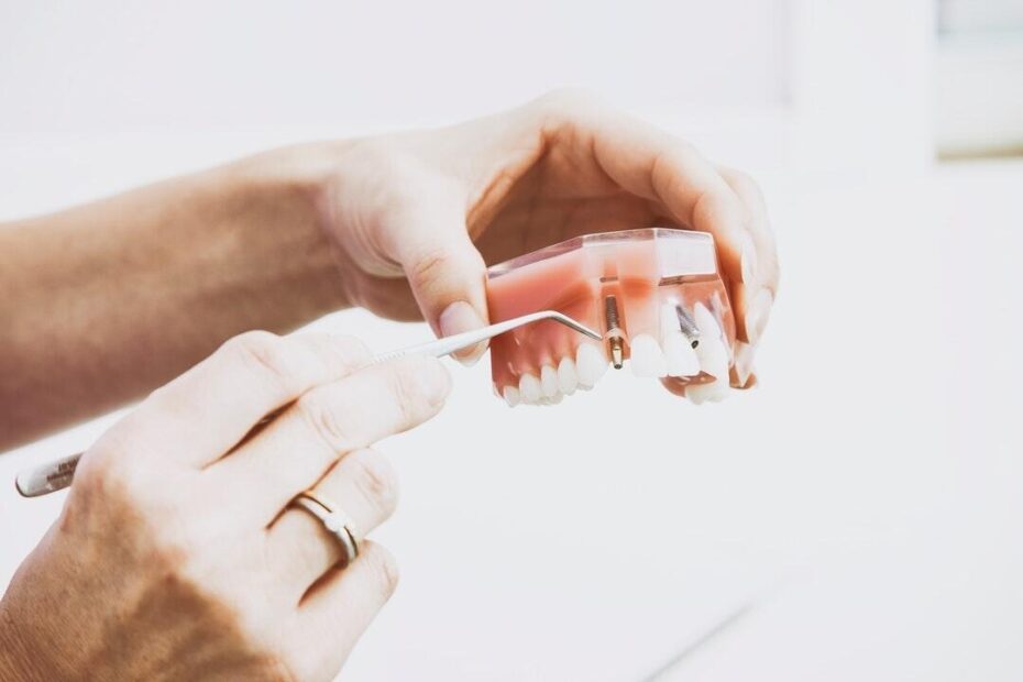 Replace Missing Teeth Naturally or Surgically