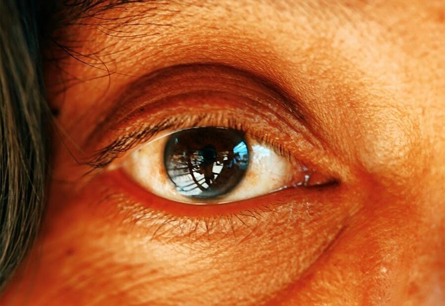Vision Changes and Management