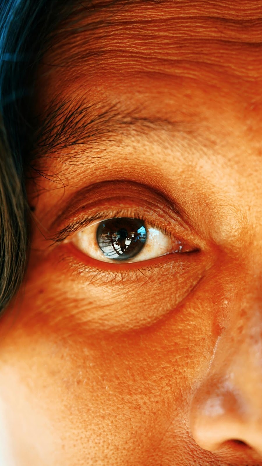Vision Changes and Management