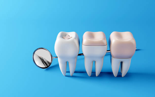 Dental Treatment