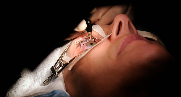 LASIK Surgery in Pune