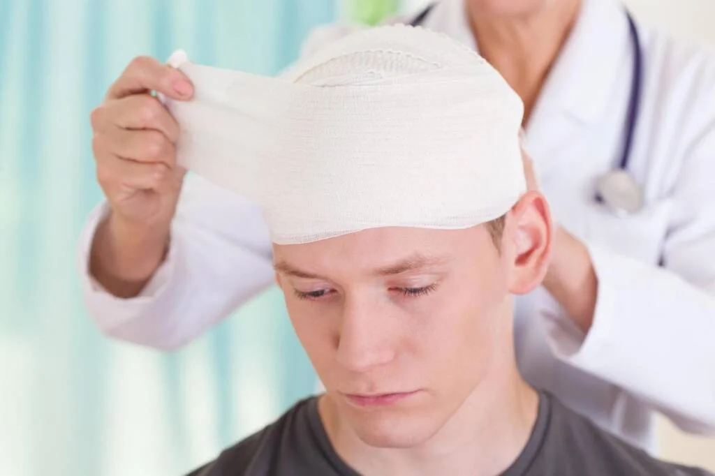 How Serious Head Injuries Can Affect Legal Claims