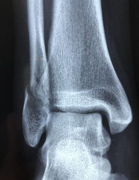 Mobile Radiology