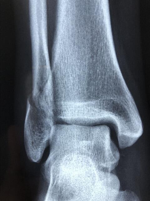 Mobile Radiology
