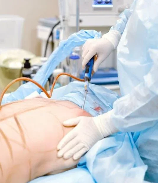 Liposuction Myths Vs. Reality